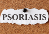 Psoriasi