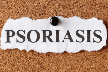 Psoriasi